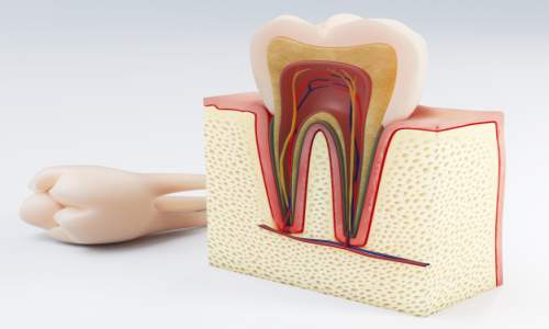 Diş Kemik Grefti Nedir?