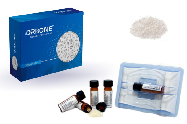 Orbone Allograft Tissue Products