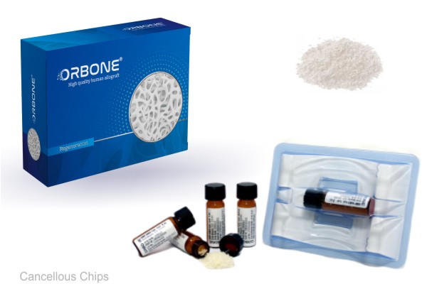 Orbone Cancellous Chips Allograft