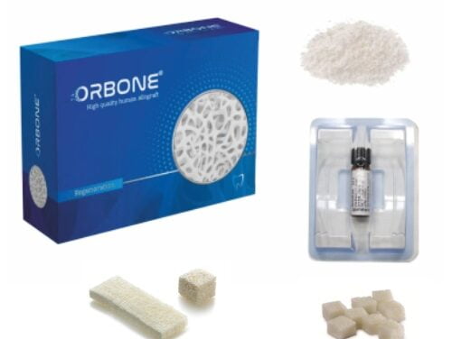 Kemik Greftleri – Allogreft