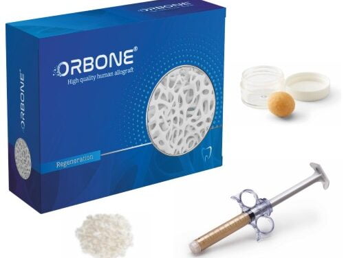 Demineralize Kemik Matriksi – DBM Şırınga